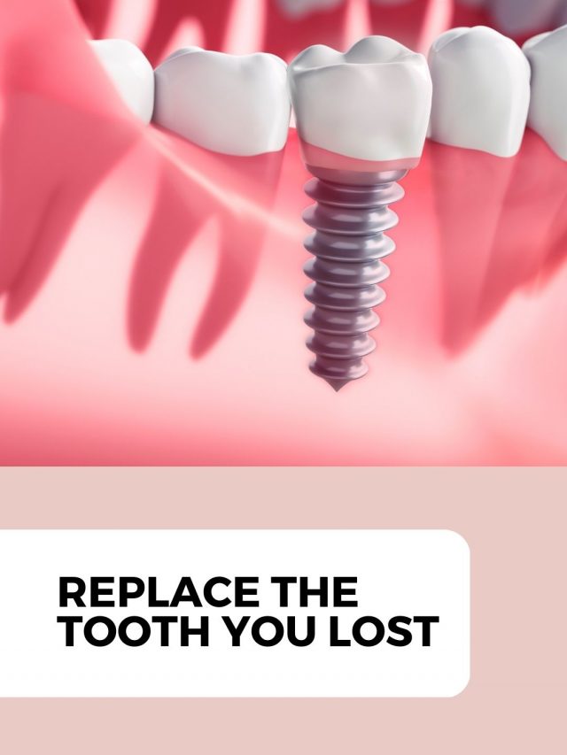 Replace your missing tooth with us