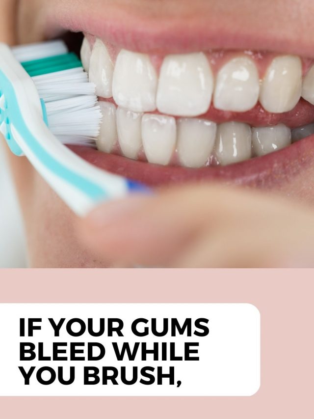 What is gum bleeding?