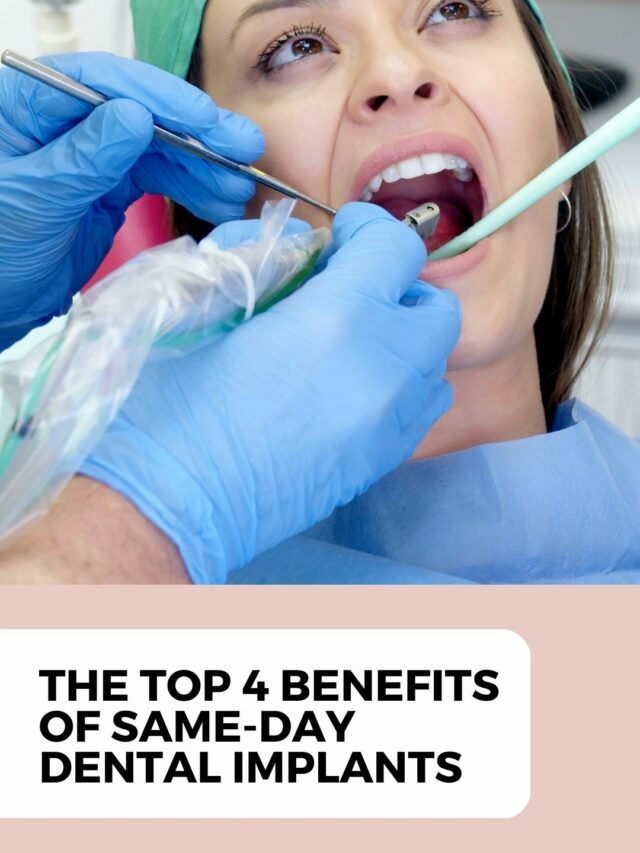 Benefits of same day dental implants